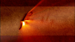 Firefly Burn